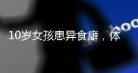 10岁女孩患异食癖
�，体内惊现“头发巨石”
