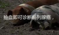 抽血即可诊断前列腺癌
，拜登为何不测？