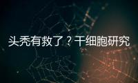 头秃有救了？干细胞研究阐明压力如何影响毛发生长